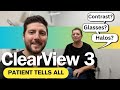 Clearview 3 lens  realworld experience after cataract surgery  refractive lens exchange