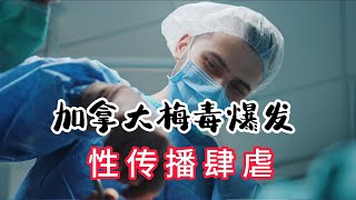 突發：梅毒疫情 席捲加拿大，性傳染引發社區恐慌！ 今日熱搜 加拿大生活