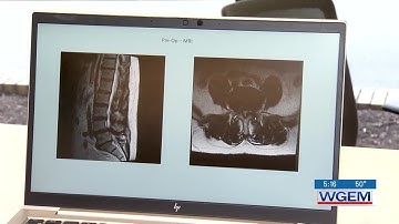 TOPS Fusion Alternative