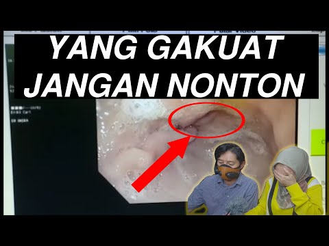 GINI LHO ISI PERUT MANUSIA! (Melalui Alat Endoskopi) - Nini Carlina Reacts