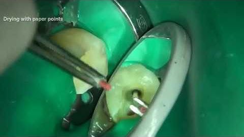 Gauging and tuning canals