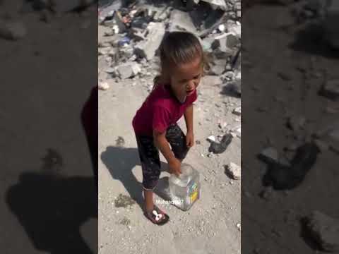 انا الطفل الي شيبتوه شاهد شوف وداع ااشطفل شهيدة