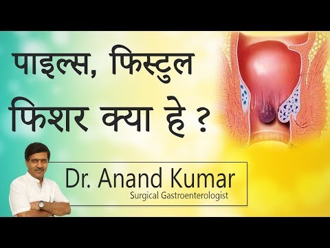 वीडियो: क्या एमी फिशर हैं?