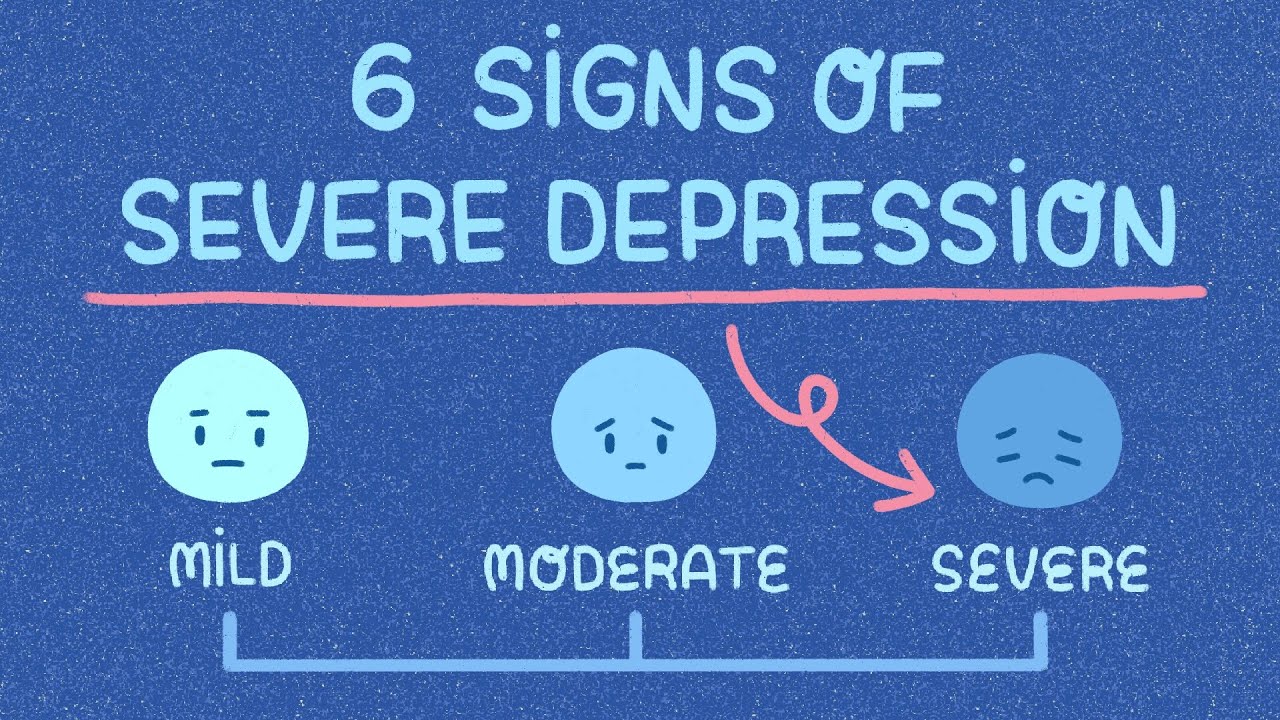 Depression severe Depression (major