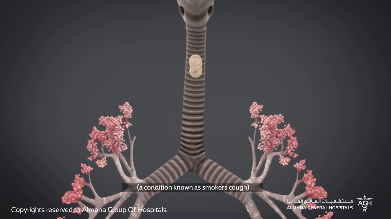 ما هو مرض الإنسداد الرئوي المزمن و ما علاقته بالتدخين؟