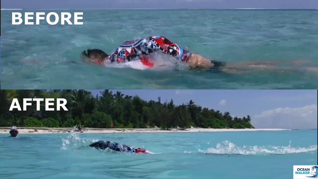 OCEAN WALKER TECHNIQUE BEFORE (conventional technique) AND AFTER OCEAN