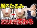 【奇跡の３分】たった3日で顔が激変！美顔器いらずで「顔のたるみ」が取れる！リフトアップと同時に首こりがふにゃふにゃになり二重顎まで取ってしまう魔法のリセットケアとは！