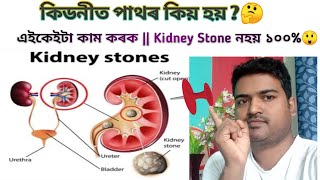 কিডনীত পাথৰ কিয় হয়|| এইকেইটা কাম কৰক|| Kidney Stone নহয় 100%?|| Awal The Pharmacist||