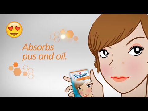 NEXCARE ACNE Covers Review - TESTING ACNE PIMPLE STICKERS OVER NIGHT + ADULT SKIN!