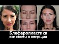 Блефаропластика цена врач реабилитация