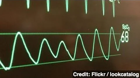 Why Near-Death Experiences Might Be Scientifically Legit