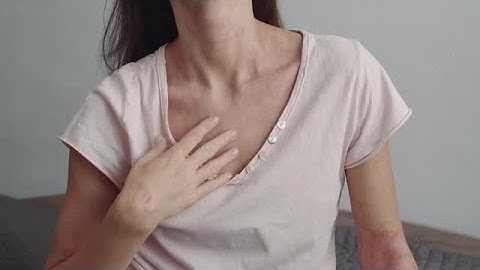 Atopic Dermatitis On Neck Stock Video