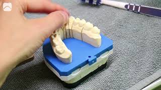 Vom Zahnarztbesuch bis zur fertigen Krone: Ein Blick hinter die Kulissen bei Flemming Dental