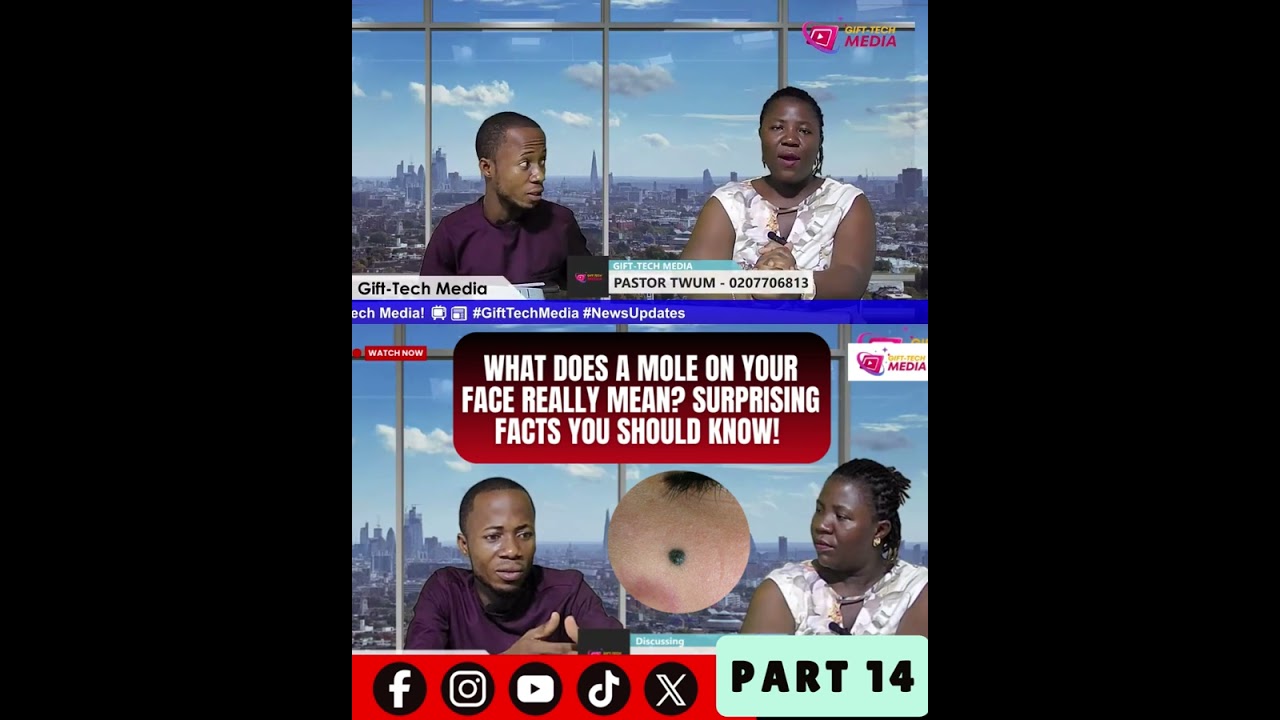 PART 14 👀 What Does a Mole on Your Face Really Mean? Surprising Meanings You Should Know! ✨