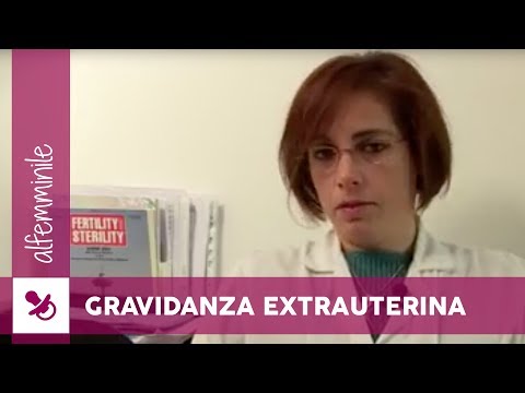Video: Gravidanza Dopo Una Gravidanza Extrauterina