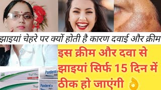 | झाइयों से कैसे पाएँ छुटकारा पाएं Melasma Treatment | Melasma Causes | Melasma Creams Review