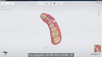 3Shape TRIOS - HD Photo ES