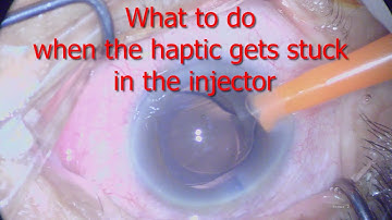 What to do when the IOL haptic gets stuck in the injector