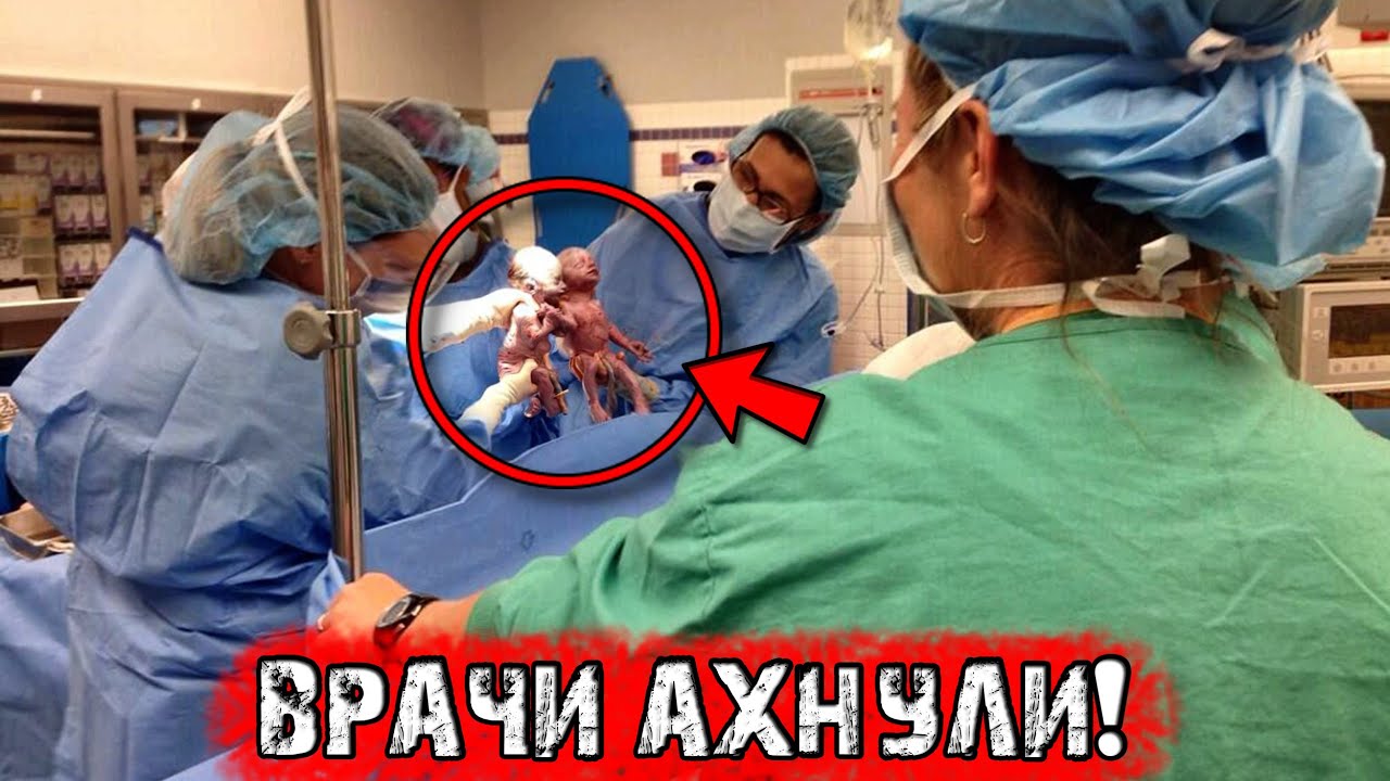 Спустя секунды после родов у акушера-гинеколога отпала челюсть, когда ...