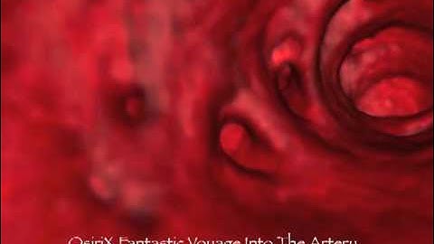 OsiriX Fantastic Voyage Into The Artery