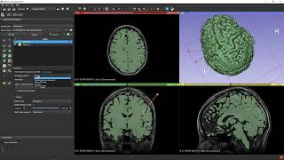Brain segmentation in 3D Slicer via mask scalar volume screenshot 4