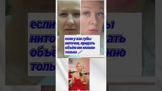 #фейсфитнес #фейсбилдингдлялица #гимнастикадлялица #безботокса #межбровка #мимика