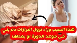 6 من أسباب نزول إفرازات بنية بعد الدورة او في موعدها ( الدم البني )