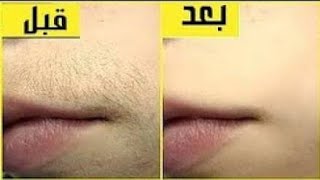 إزالة شعر الوجه بالنشا / شعر فوق الشفايف / تقليل نمو الشعروتفتييح البشرة من اول استخدام