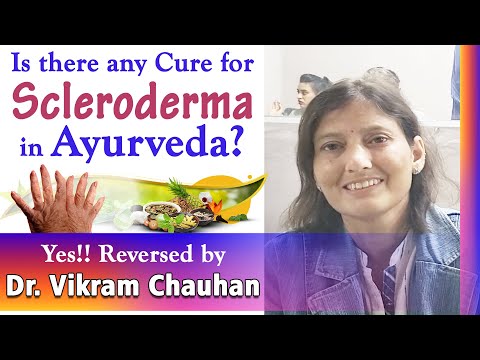 Watch Video Is there any Cure for Scleroderma in Ayurveda - Reversed by Dr. Vikram Chauhan