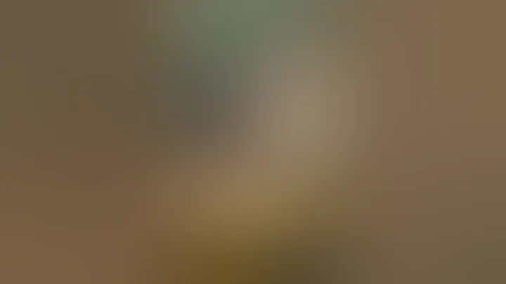 Facial Asymmetry Correction with Custom JAW ANGLE + CHIN Implants | Newport Beach Plastic Surgery