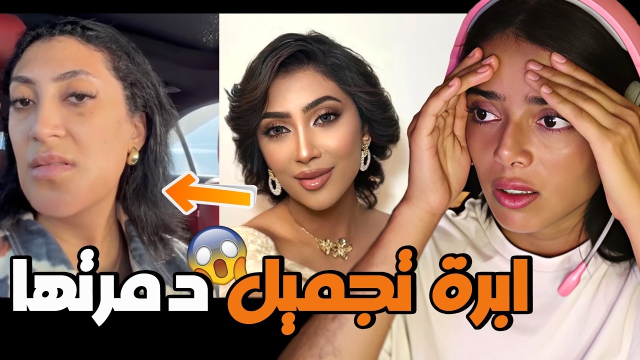 قصّة تالا صفوان || الهوس بالتجميل ينتهي بكارثة