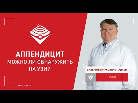 Можно ли на УЗИ обнаружить аппендицит?