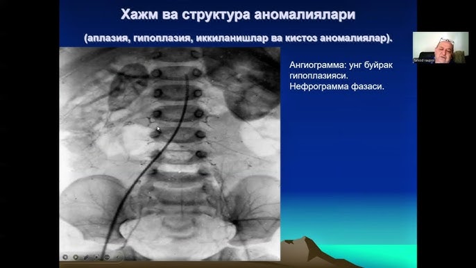Xotin va katta sik Gomoseksual askar armiya hojatxonasida silkitmoqda