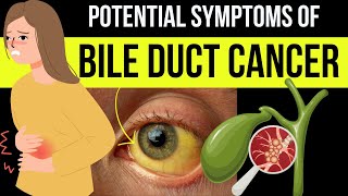 Doctor explains WARNING SYMPTOMS and SIGNS of BILE DUCT CANCER (aka Cholangiocarcinoma)