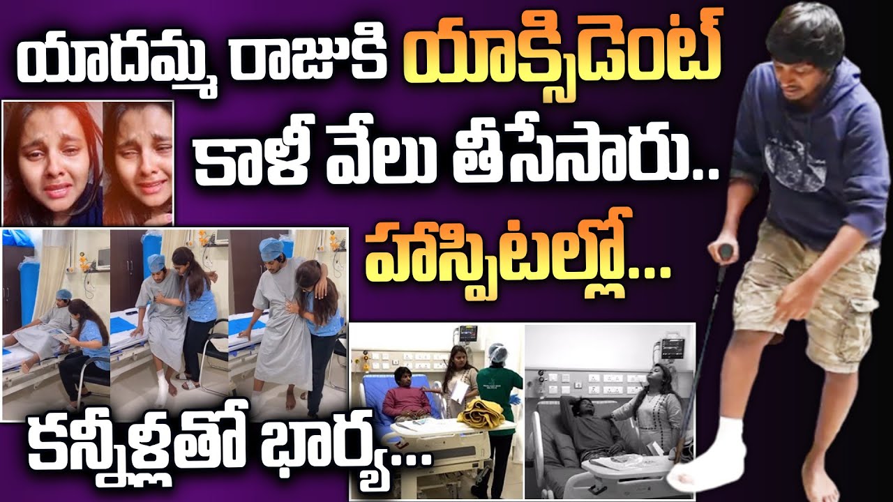 Ambugam Raju Rao యాదమ్మ రాజుకి యాక్సిడెంట్ | Yadamma Raju Emotional Interview Brahm ...