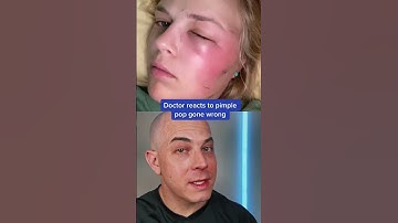 Doctor reacts to the risks of pimple popping! #pimple #pimplepopper #dermreacts