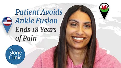 Avoiding Ankle Fusion & Ending 18 Years of Pain (Ankle Surgery Patient Recovery Story)