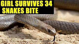 Himachal Girl Survives 34 Snakes Bite Over 3 Years | Oneindia News