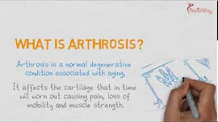 Find the Difference: Best Arthritis Treatment and Best Arthrosis Treatment | PlacidWay