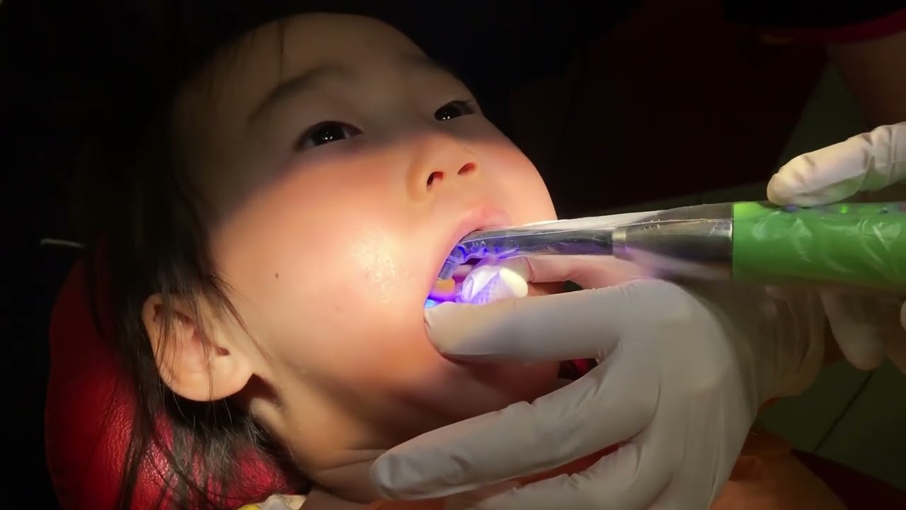 일본일상 세자매 브이로그│일본 어린이 치과 충치예방 치료