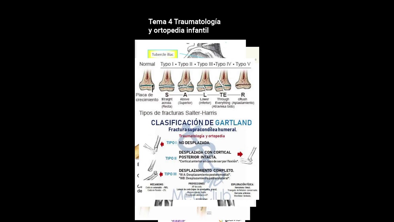 Tema 4 Traumatología y ortopedia infantil
