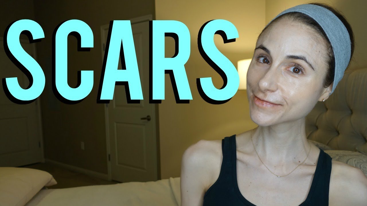 Getting rid of scars scar creams,, dermarollers, collagen supplements