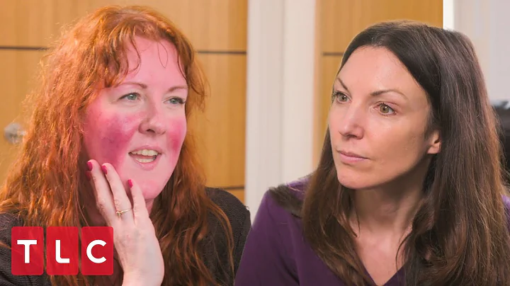 Emma's Rosacea Flares Red Hot | Save My Skin