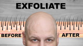 YOU NEED TO EXFOLIATE a Bald Head and here is Why