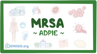 MRSA: Nursing Process