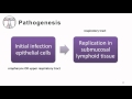 4. Enterovirus pathogenesis & immune response