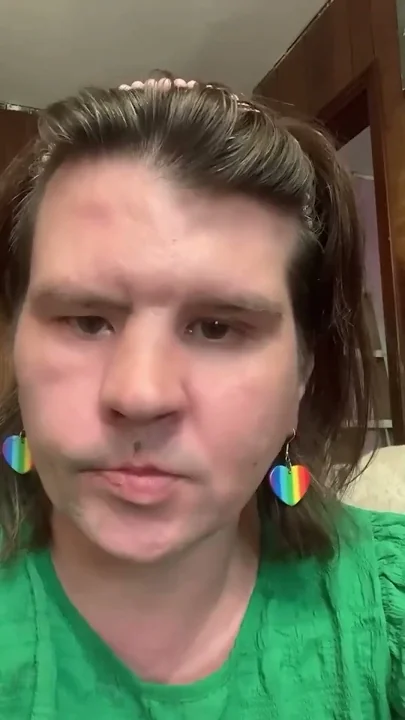 A White Black Woman Who Identifies As A Dog #shortsvideo #shorts