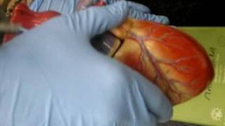 SDC10418.AVI
