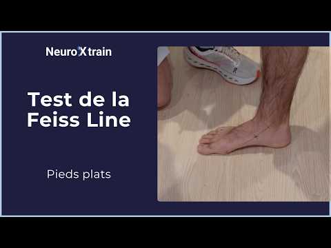 Feiss Line Test