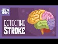 LEARN THIS to save someone // Detecting STROKE